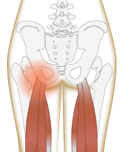 Pain in the butt: hamstring attachement