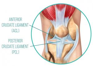 acl_pcl